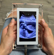 Digital Photo Frame - Relive Every Precious Moment in Crystal Clarity!