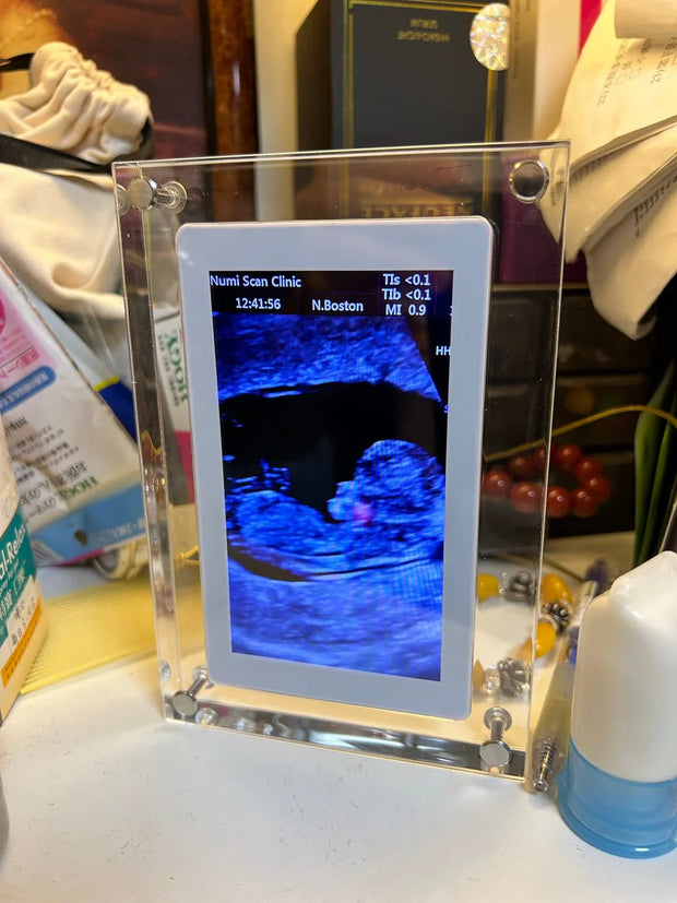Digital Photo Frame - Relive Every Precious Moment in Crystal Clarity!